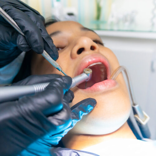 Dental