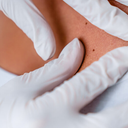 Dermatology